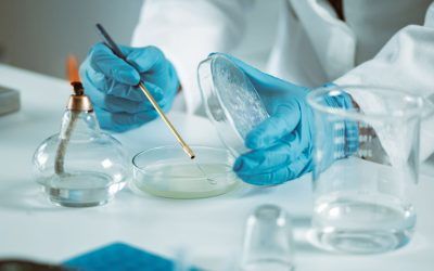 Prueba de cultivo vaginal en el embarazo. ¿Cuándo y por qué?
